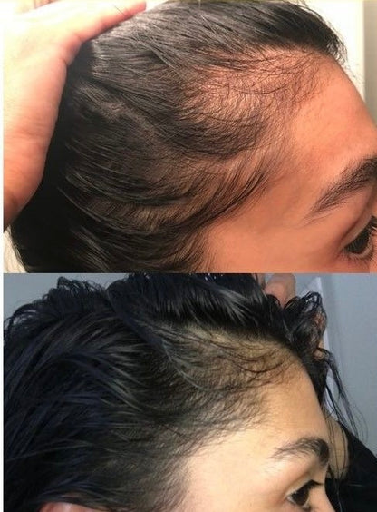 Herbrise Herbal Hair OIL | Strengthen Hair | 1000+ Trusted Our Client