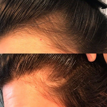 Herbrise Herbal Hair OIL | Strengthen Hair | 1000+ Trusted Our Client